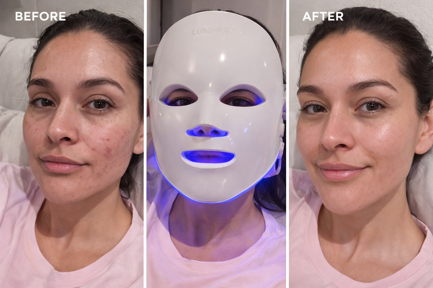 Beautybeat LUMI•PRO™ LED Therapy Mask