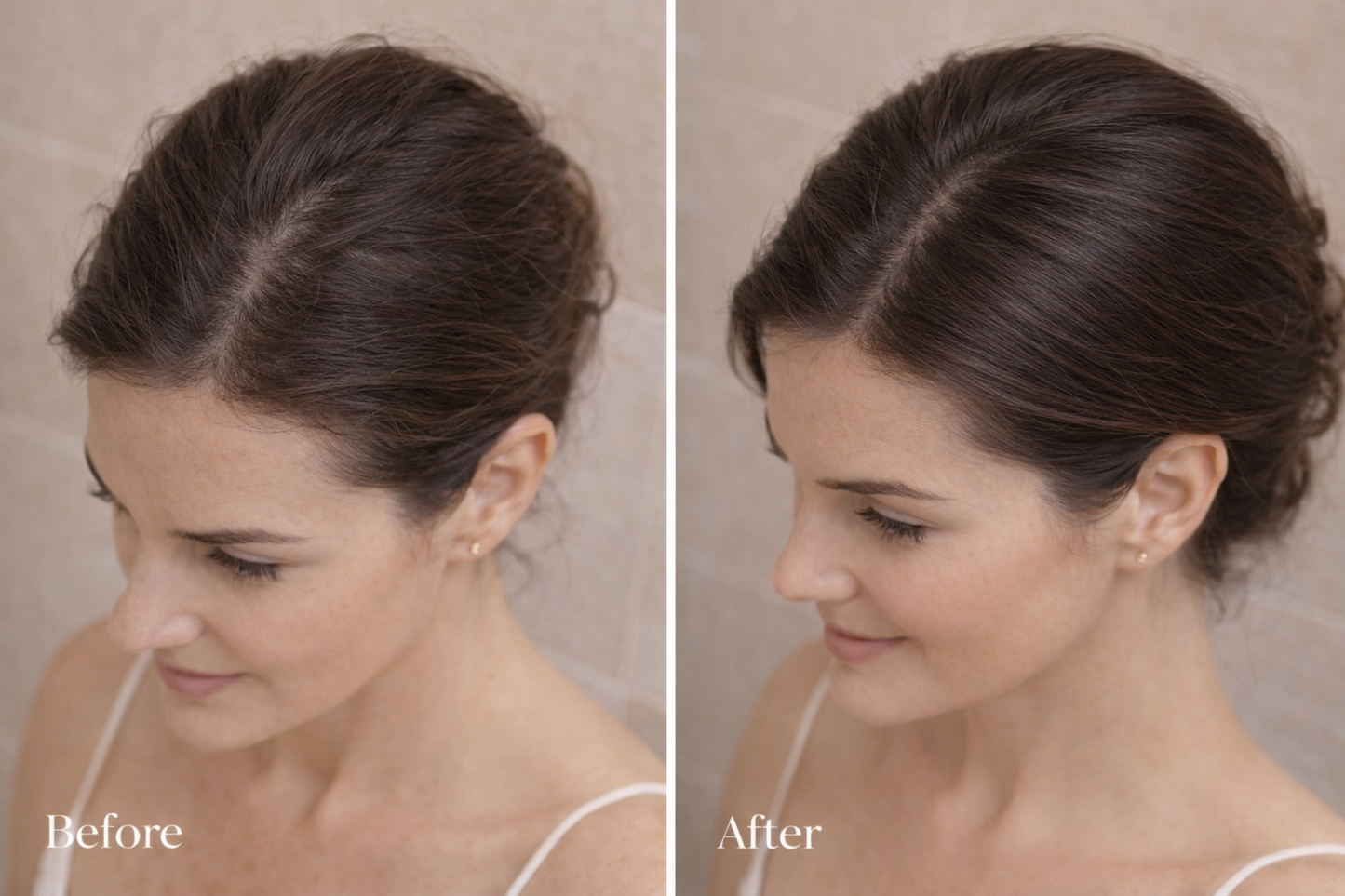 Beautybeat SCALP•FLOW™ Pro